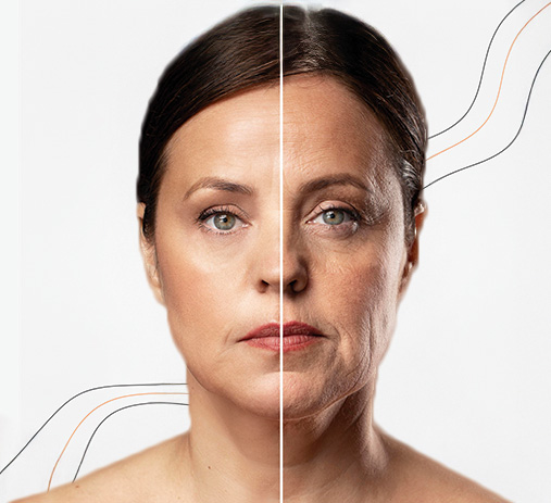 Harmonização facial