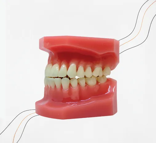 Prótese sobre implante