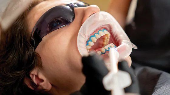 Odontologia Preventiva: sorriso saudável para sempre