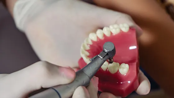 Seus benefícios: Tenha um reparo discreto e natural