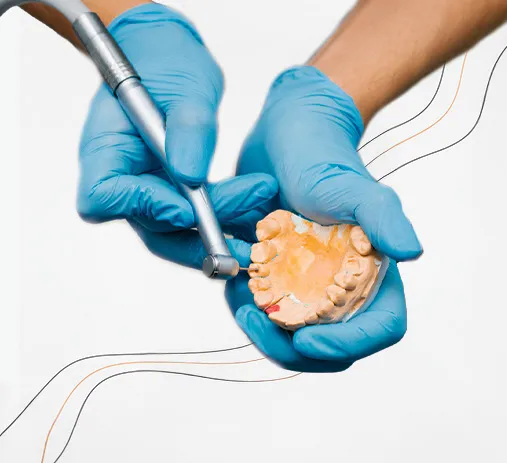 Restaurações em resina